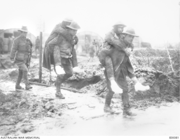 Australian ambulance men assisting comrades suffering from trench feet, France, 1916